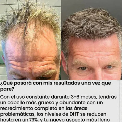 FolixDerm – Reactiva tu Crecimiento Capilar