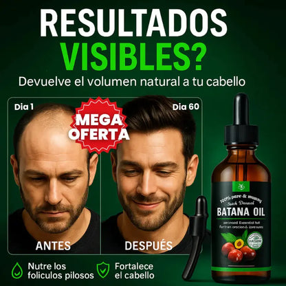 BatanaGlow™ – Aceite Regenerador 100% Natural, Restaura tu Cabello, Frena la Caída y Revive el Brillo (2x1)