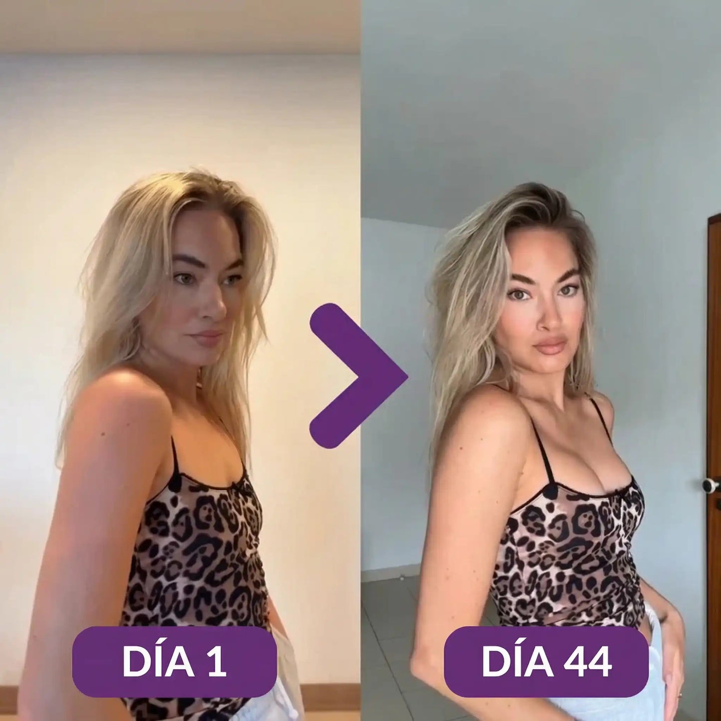 FENOGREK ™ - Realce sin cirugias