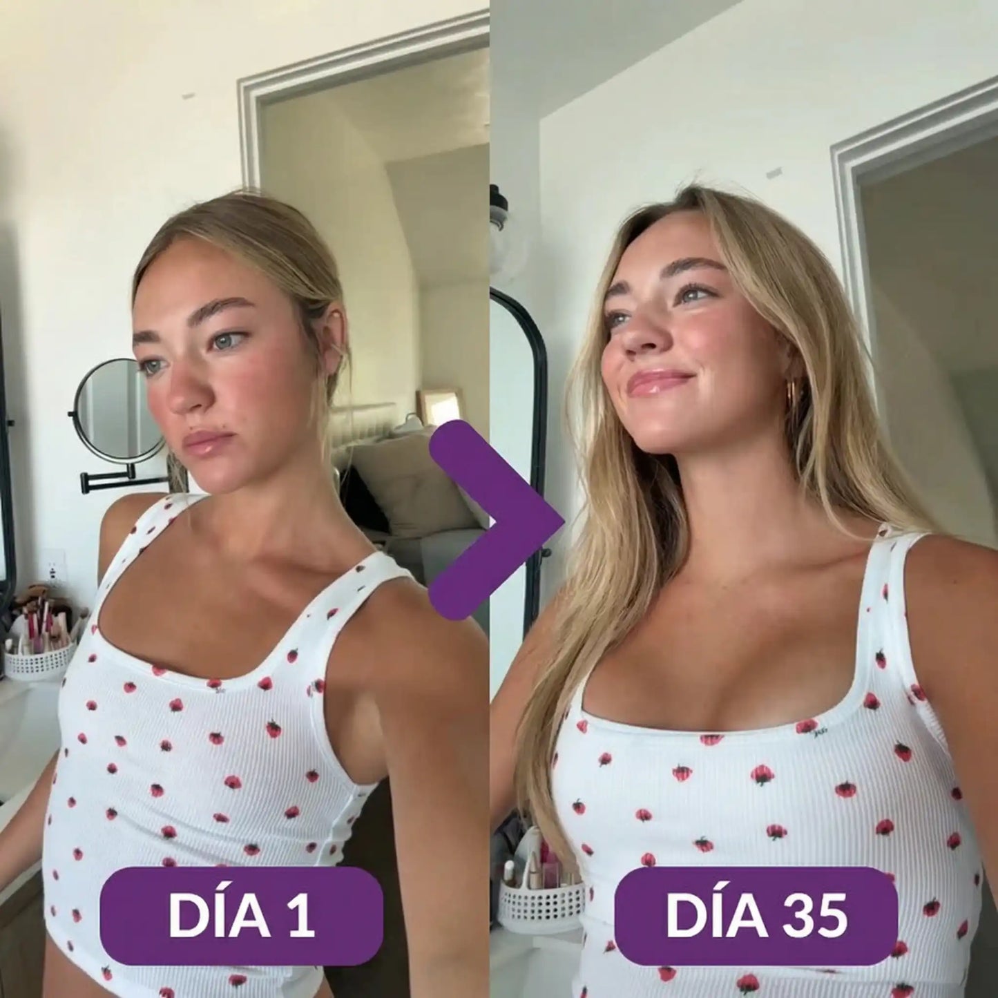 FENOGREK ™ - Realce sin cirugias